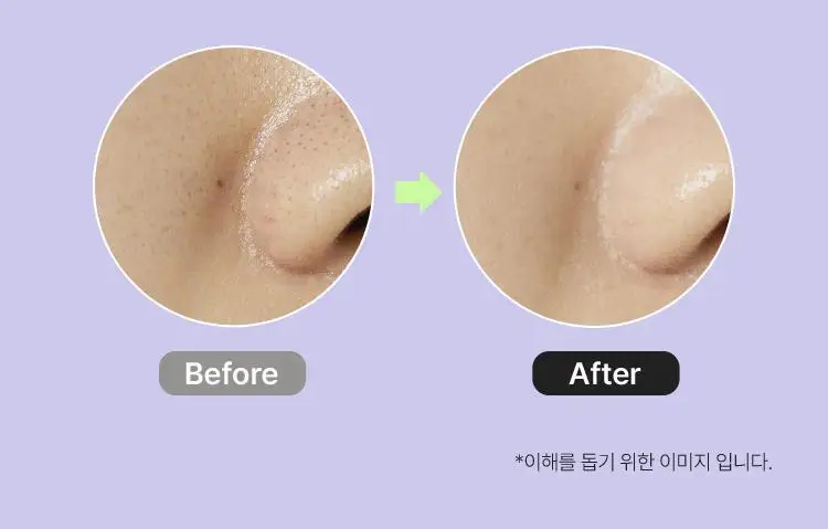[모공피지] 마몽드 포어 슈링커 바쿠치올 패드 70매 상세페이지 5